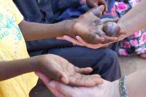 Het hand is ondertussen niet behandeld geweest